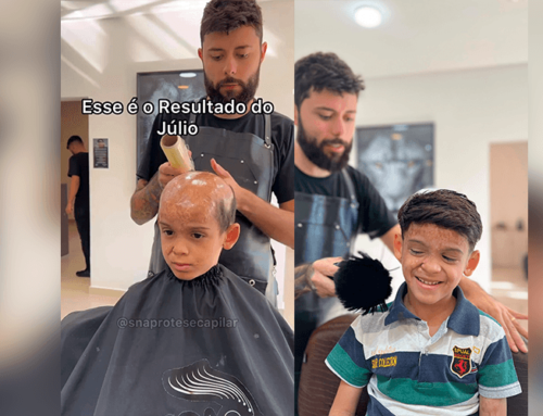 Estúdio capilar realiza sonho de menino com queimadura na cabeça doando prótese capilar; Vídeo.
