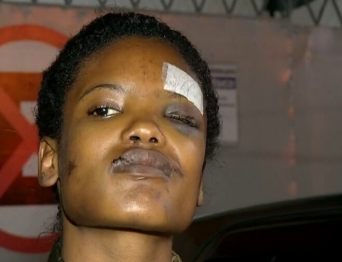 Modelo denuncia agressão brutal do namorado após jogo do Brasil em Magé